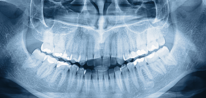 radiografías, fotografías dentales